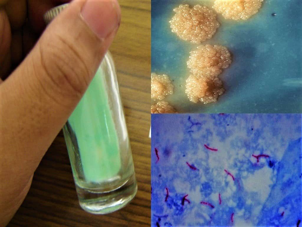 Process Sputum Samples In Lab Resume Examination Of Sputum Specimen In Laboratory Microbiology Practicals
