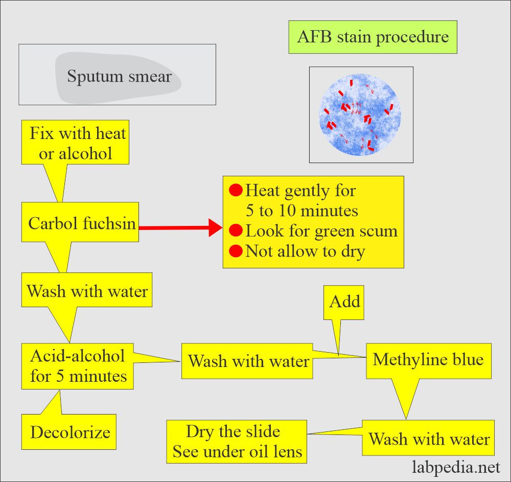 Process Sputum Samples In Lab Resume Mycobacterium Tuberculosis:- Part 4 – Afb Stain (acid Fast Bacilli …