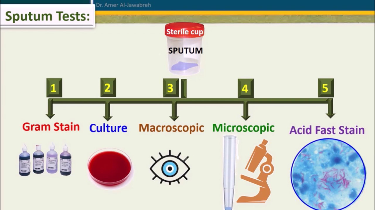 Process Sputum Samples In Lab Resume Sputum Culture-when to Reject Sample?