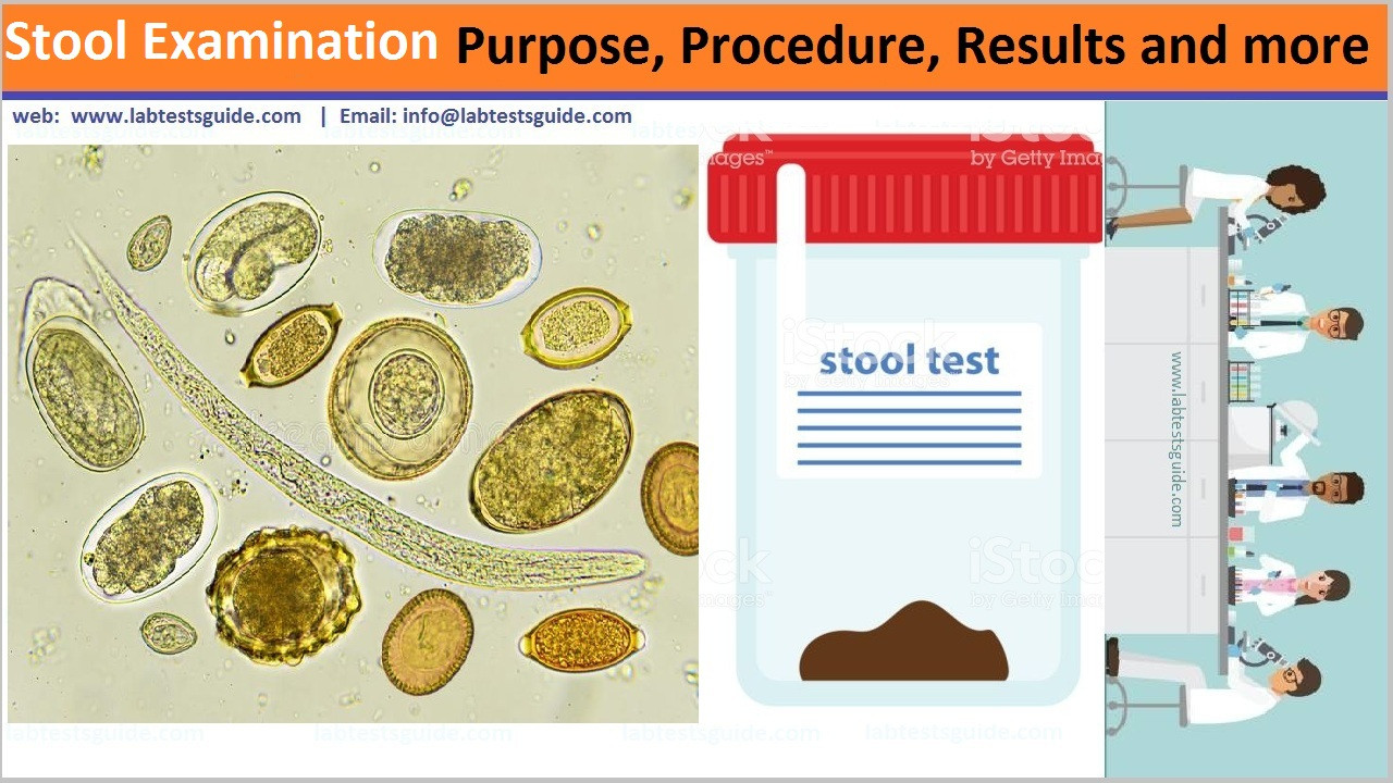 Process Stool Samples In Lab Resume Stool Examination Purpose, Procedure, Results and More Lab Tests …