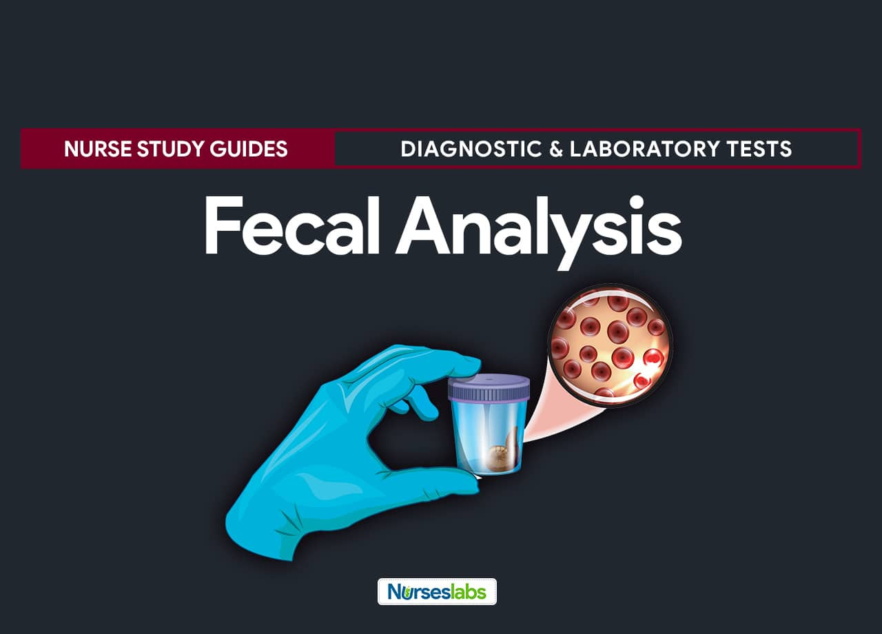 Processed Stool Samples In Lab Resume Fecal Analysis (stool Analysis) Nursing Responsibilities – Nurseslabs