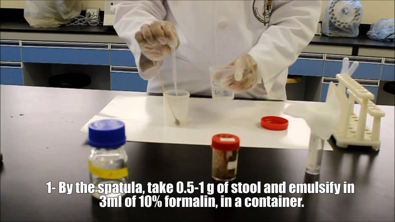 Processed Stool Samples In Lab Resume Microscopic Examinations Of Stool Sample