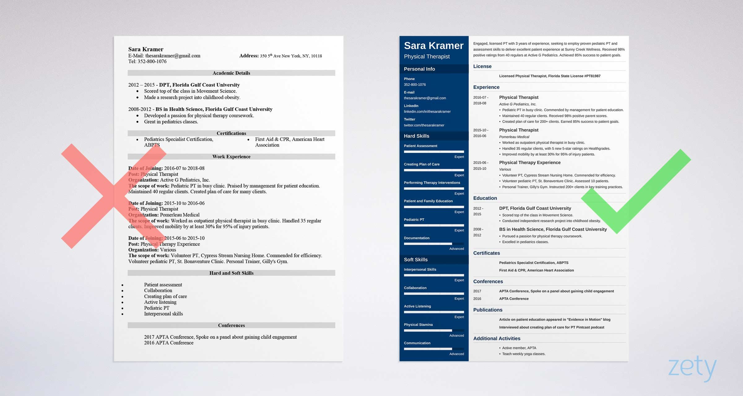 Sample Resume for Entry Level Physical therapist assistant Physical therapist and Pta Resume Examples & Guide