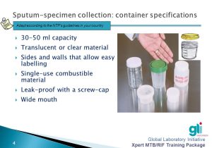 Process Sputum Samples In Lab Resume Collecting and Transporting Sputum Specimens – Ppt Video Online …