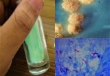 Process Sputum Samples In Lab Resume Examination Of Sputum Specimen In Laboratory Microbiology Practicals