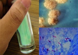 Process Sputum Samples In Lab Resume Examination Of Sputum Specimen In Laboratory Microbiology Practicals