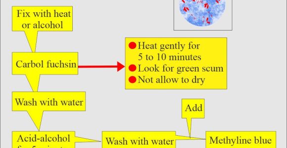 Process Sputum Samples In Lab Resume Mycobacterium Tuberculosis:- Part 4 – Afb Stain (acid Fast Bacilli …