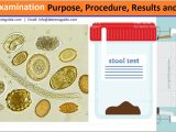 Process Stool Samples In Lab Resume Stool Examination Purpose, Procedure, Results and More Lab Tests …