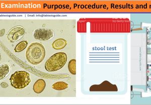Process Stool Samples In Lab Resume Stool Examination Purpose, Procedure, Results and More Lab Tests … Process Stool Samples In Lab Resume Stool Examination Purpose, Procedure, Results and More Lab Tests …