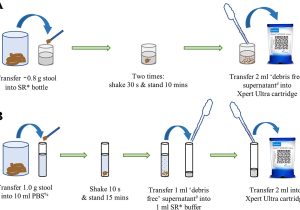 Process Stool Samples In Lab Resume the Simple One-step (sos) Stool Processing Method for Use with the … Process Stool Samples In Lab Resume the Simple One-step (sos) Stool Processing Method for Use with the …