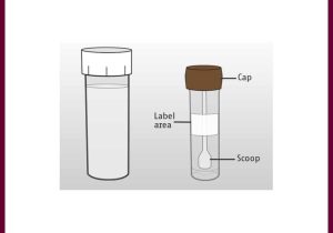 Processed Stool Samples In Lab Resume Fecal Analysis (stool Analysis) Nursing Responsibilities – Nurseslabs