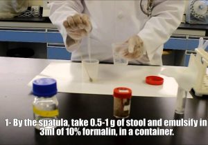 Processed Stool Samples In Lab Resume Microscopic Examinations Of Stool Sample Processed Stool Samples In Lab Resume Microscopic Examinations Of Stool Sample