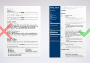 Sample Resume for Medical Technologist Fresh Graduate Medical Technologist Resume: Samples and Guide